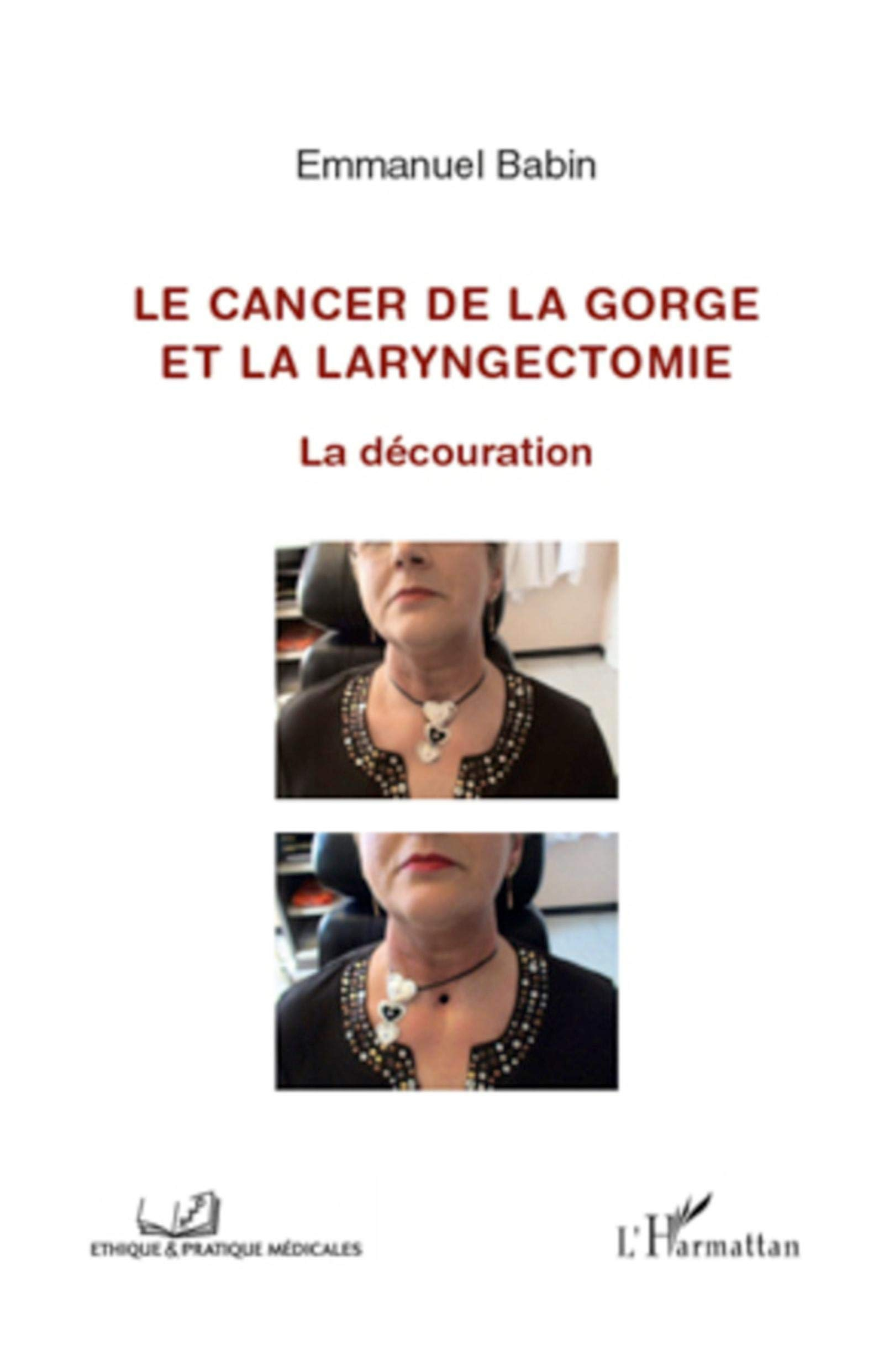 Le cancer de la gorge et la laryngectomie : la découration