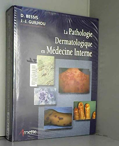 La pathologie dermatologique en médecine interne