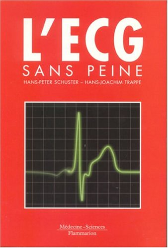L'ECG sans peine