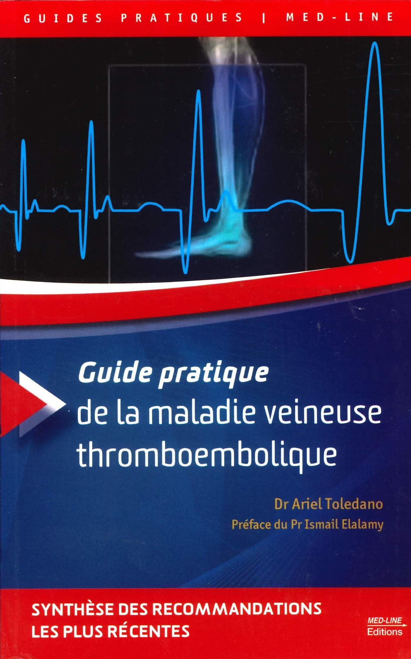 Guide pratique de la maladie veineuse thromboembolique