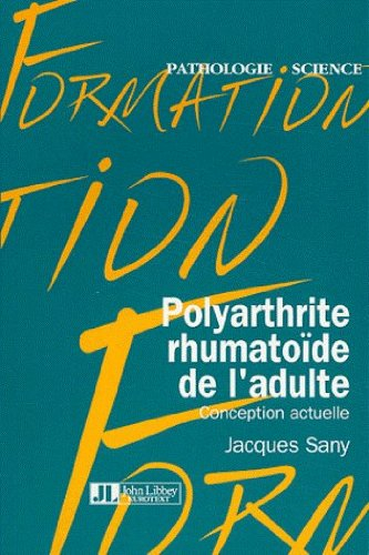 La polyarthrite rhumatoïde de l'adulte