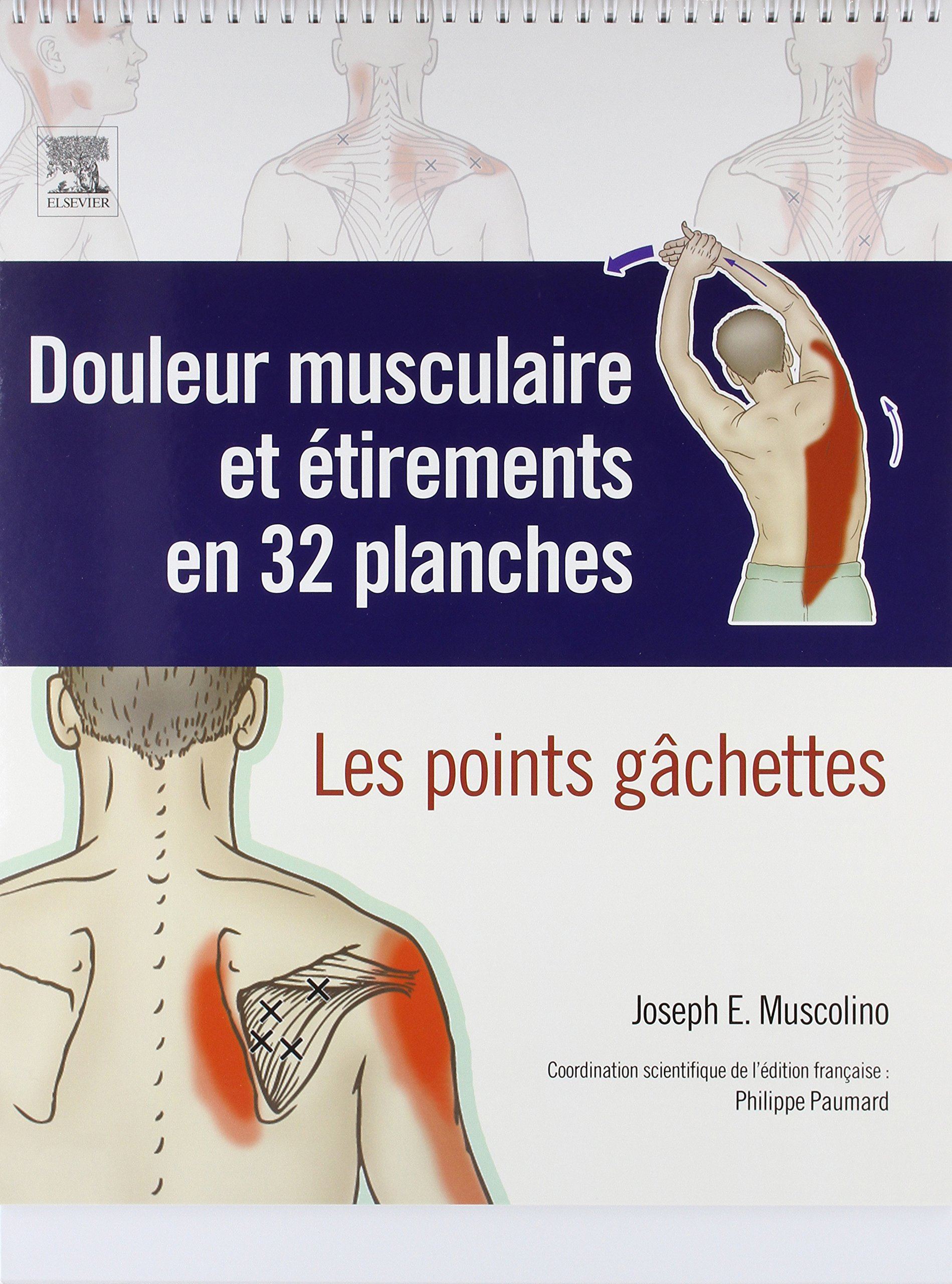 Douleur musculaire et étirements en 32 planches : les points gâchettes