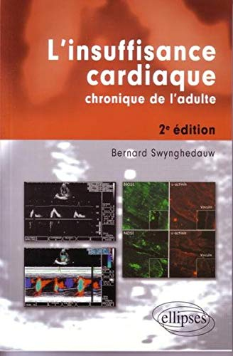L'insuffisance cardiaque chronique de l'adulte