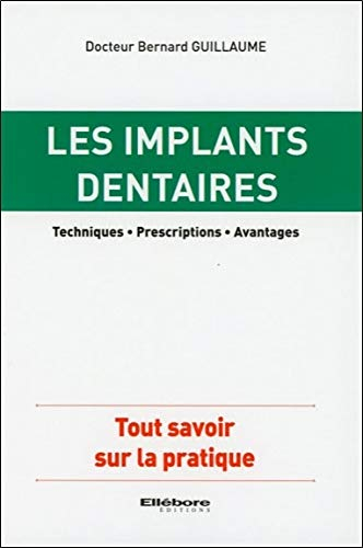 Les implants dentaires : techniques, prescriptions, avantages : tout savoir sur la pratique