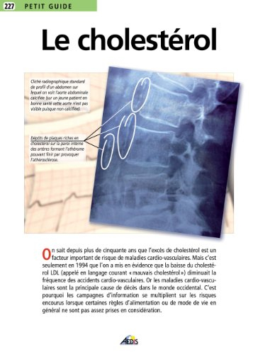 Le cholestérol