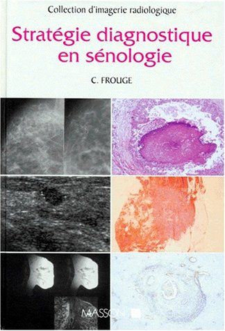 Stratégie diagnostique en sénologie