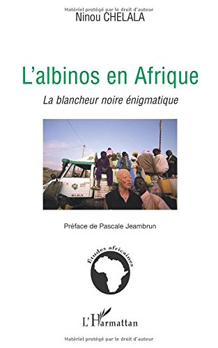 L'albinos en Afrique : la blancheur noire énigmatique