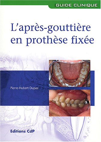 L'après-gouttière en prothèse fixée