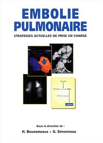 Embolie pulmonaire : stratégies actuelles de prise en charge