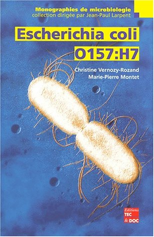 Escherichia coli O157:H7