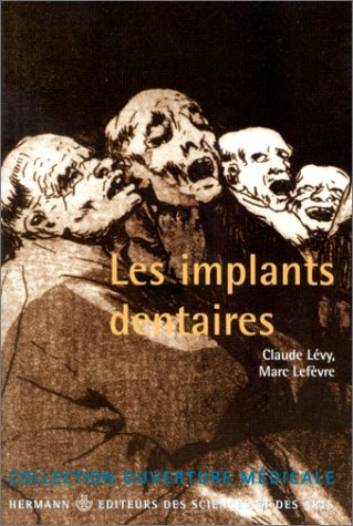 Les implants dentaires