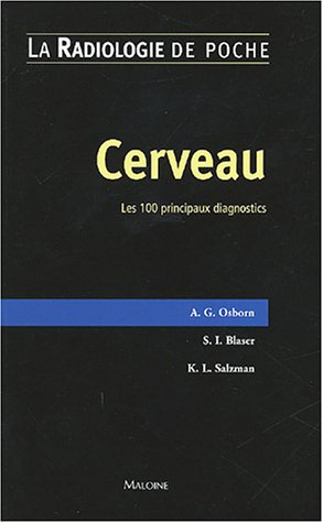 Cerveau : les 100 principaux diagnostics
