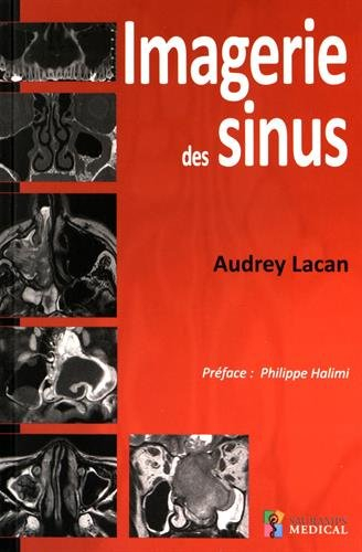 Imagerie des sinus