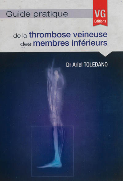 Guide pratique de la thrombose veineuse des membres inférieurs