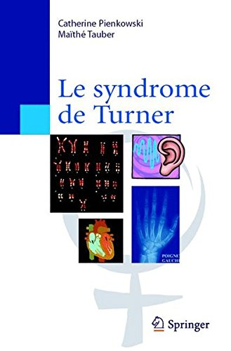 Le syndrome de Turner