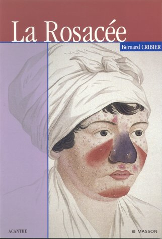 La rosacée