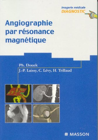 Angiographie par résonance magnétique