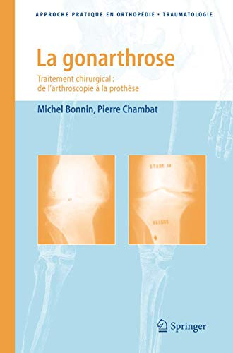 La gonarthrose