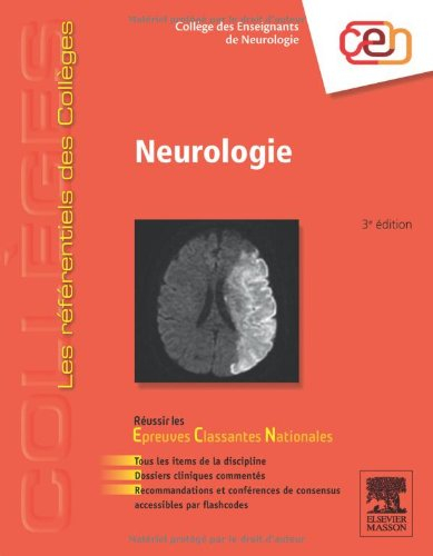 Neurologie : réussir les épreuves classantes nationales