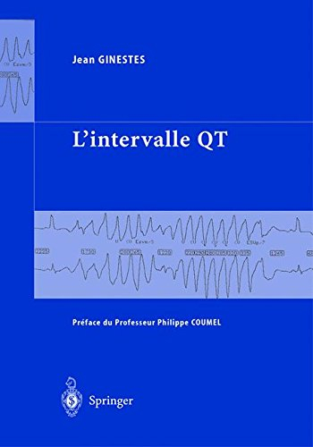 L'intervalle QT
