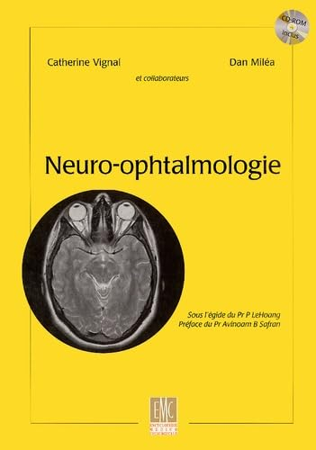 Neuro-ophtalmologie
