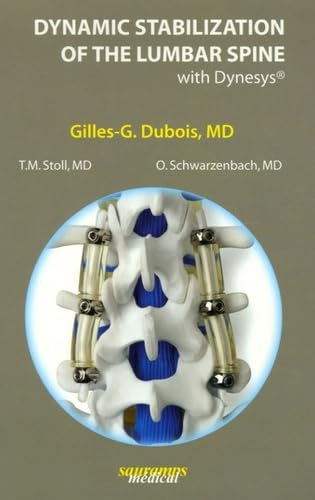 Dynamic stabilization of the lumbar spine with Dynesys