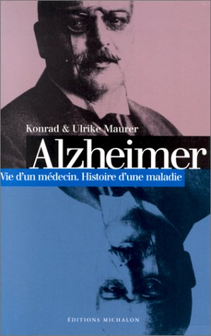 alzheimer