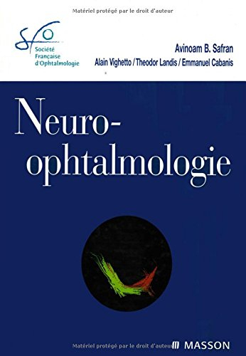 Neuro-ophtalmologie