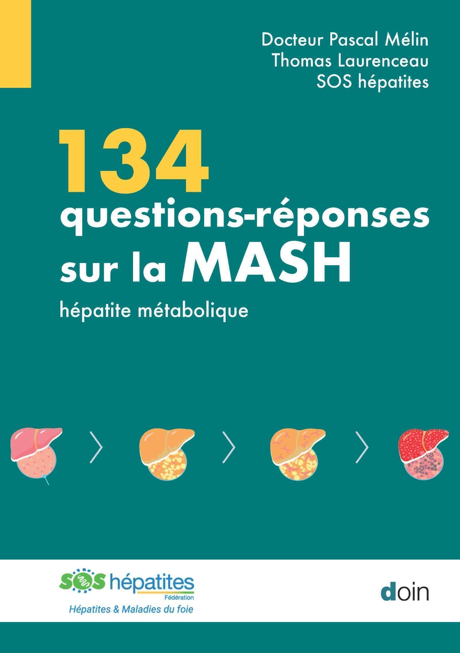 134 questions-réponses sur la MASH : maladie du foie gras