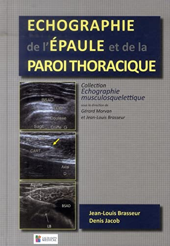 Echographie de l'épaule et de la paroi thoracique