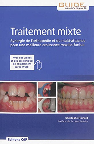 Traitement mixte : synergie de l'orthopédie et du multi-attaches pour une meilleure croissance maxil