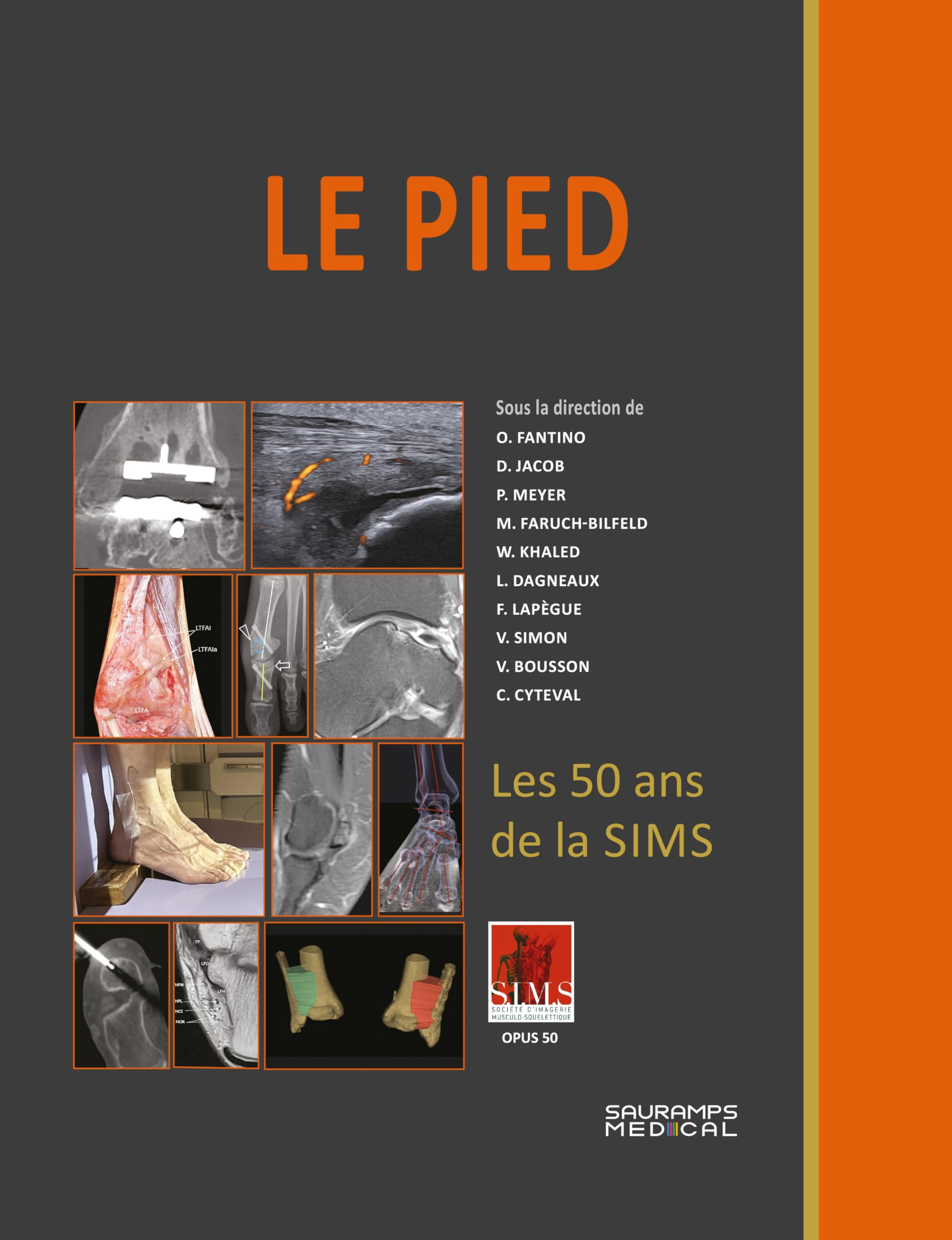 Le pied : l'avant-pied, tendons, retinacula et fascia, les ligaments de la cheville, les arthropathi