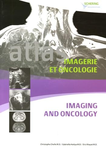 Atlas d'imagerie et oncologie