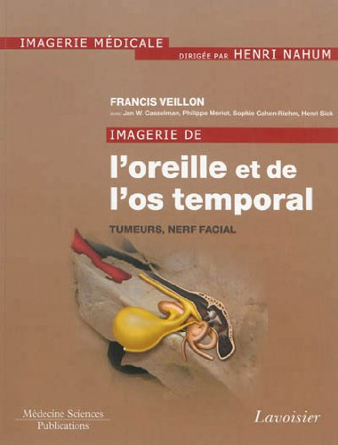 Imagerie de l'oreille et de l'os temporal. Vol. 4. Tumeurs, nerf facial