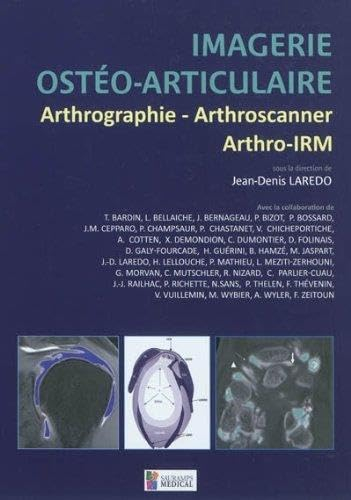 Imagerie ostéo-articulaire : arthrographie, arthroscanner, arthro-IRM