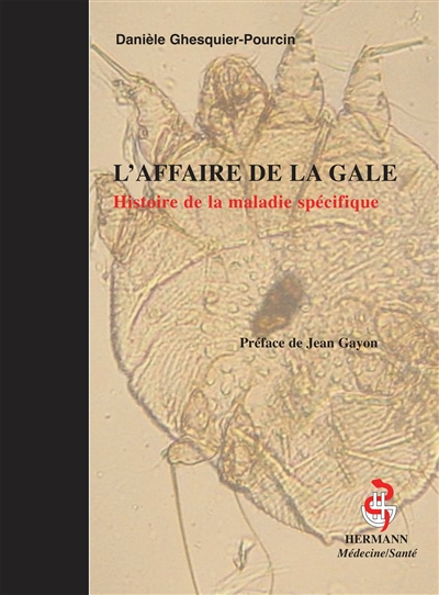 L'affaire de la gale : histoire de la maladie spécifique