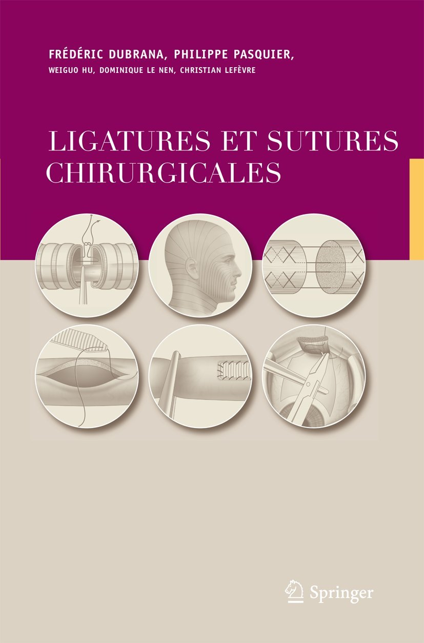 Ligatures et sutures chirurgicales