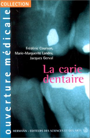 La carie dentaire
