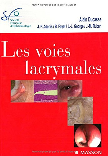 Les voies lacrymales