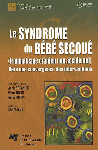 Le syndrome du bébé secoué, traumatisme crânien non accidentel : vers une convergence des interventi