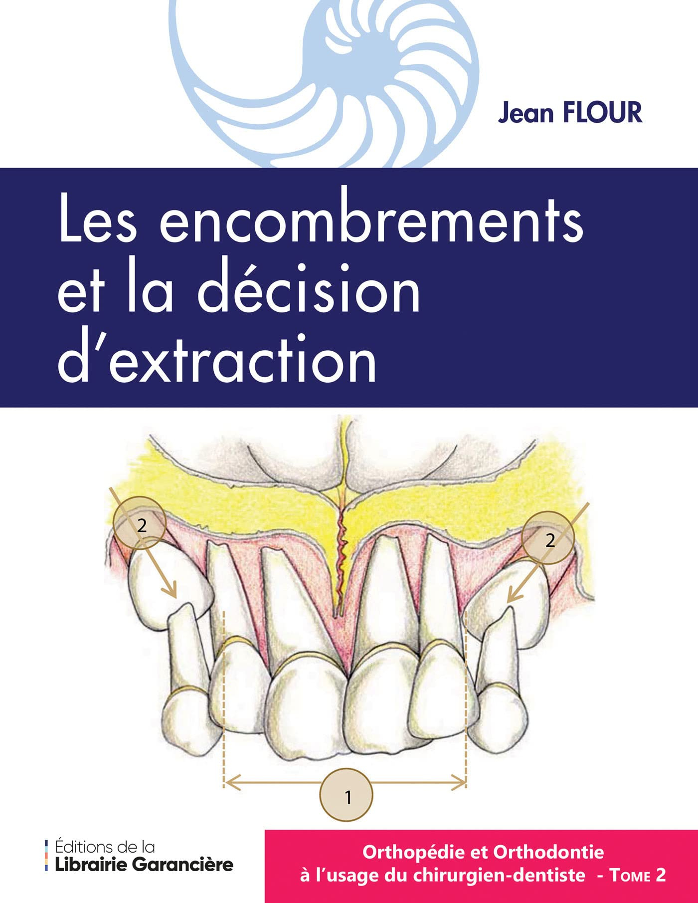 Orthopédie et orthodontie à l'usage du chirurgien-dentiste. Vol. 2. Les encombrements et la décision