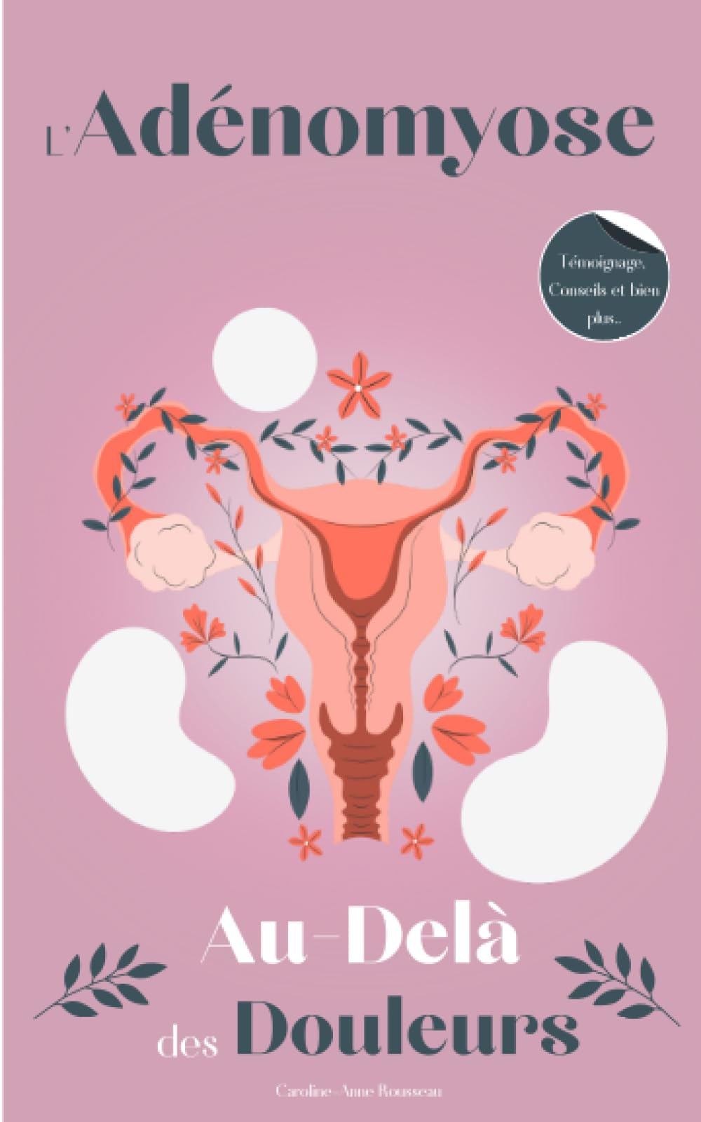 L'Adénomyose: Au-Delà des Douleurs