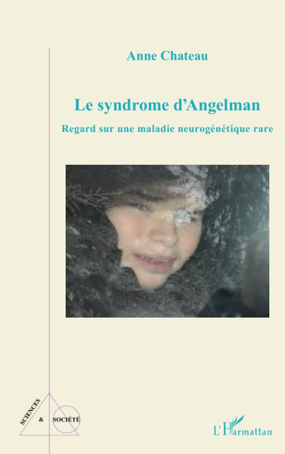 Le syndrome d'Angelman : regard sur une maladie neurogénétique rare