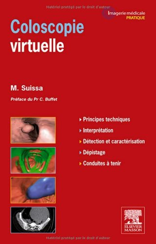 Coloscopie virtuelle