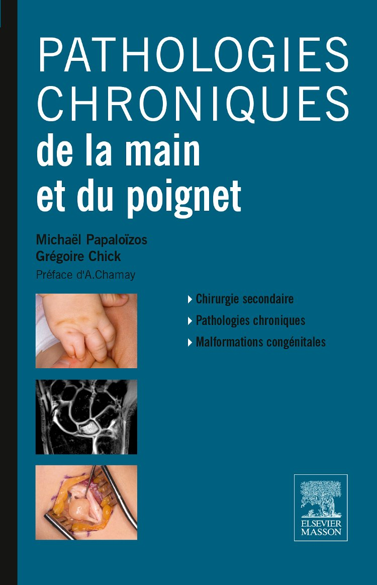Pathologies chroniques de la main et du poignet : chirurgie secondaire, pathologies chroniques, malf