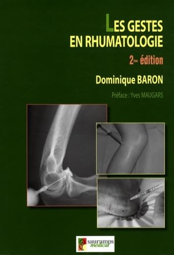 Les gestes en rhumatologie