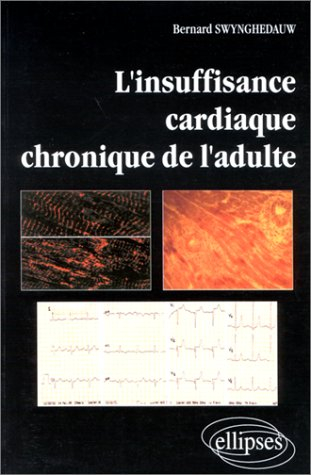 L'insuffisance cardiaque chronique de l'adulte