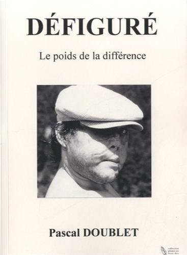 Défiguré : le poids de la différence