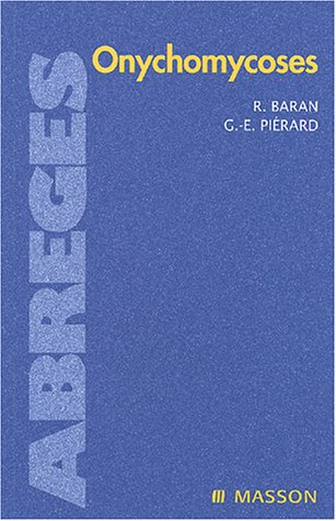 Onychomycoses