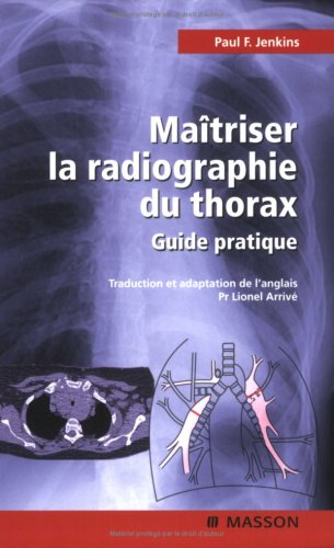 Maîtriser la radiographie du thorax : guide pratique